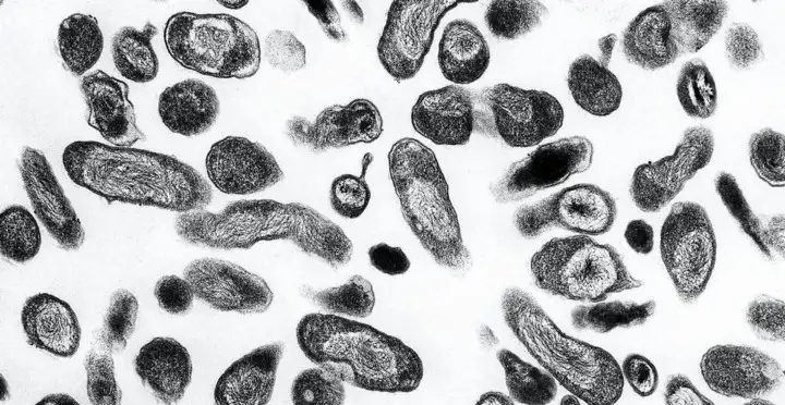 TEM-microscope-image-