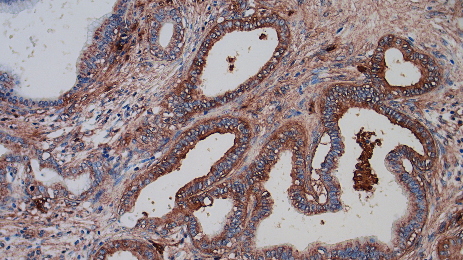 SRI is working on a new precision immunotherapy to help fight cancer